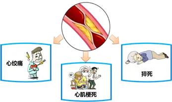 冠心病护理要点：饮食、运动与情绪管理，守护你的小红心