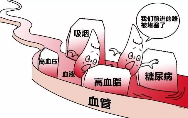 冠心病病例报告_冠心病的病例_冠心病的病例如何书写