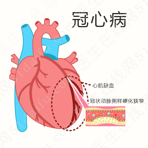 冠心病的病例如何书写_冠心病病例报告_冠心病的病例