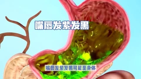胃病为什么久治不愈论坛-胃病反复发作？原因可能是这些，你中了几个？