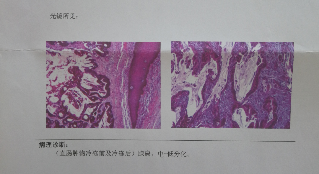 冠心病的护理诊断措施_护理诊断冠心病措施包括_冠心病的护理诊断及护理措施