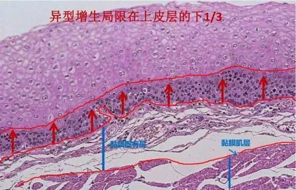 胃炎天涯论坛_胃病 天涯_我治好胃病的亲身经历天涯
