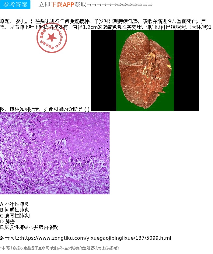 肺结核严重了会怎样_肺结核严重会变肺癌吗_肺结核严重会死吗