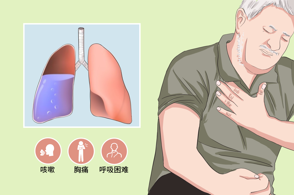 气胸严重吗_严重气胸肺胸膜回缩多少厘米_严重气胸有生命危险吗