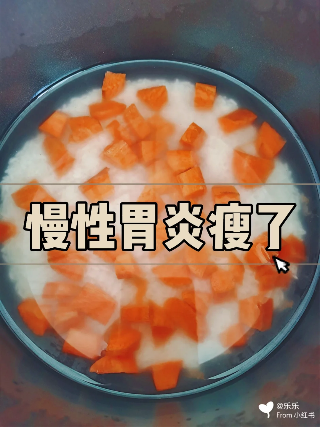 慢性胃炎胃阴不足_胃阴不足型慢性胃炎_慢性胃炎胃阴亏虚