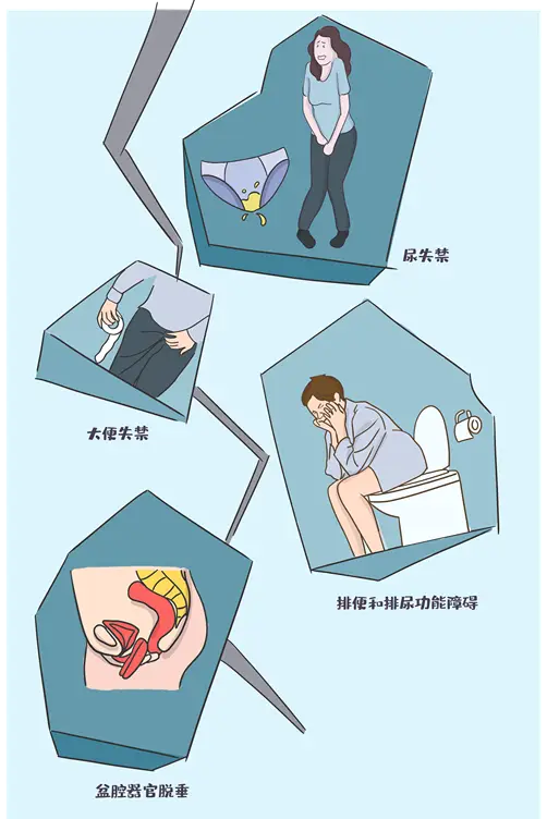 肛门失禁_肛门失禁_肛门失禁