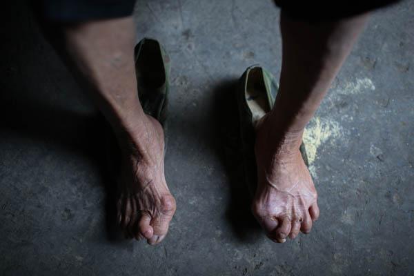 朝阳医院骨科怎么样_朝阳医院骨科大夫出诊时间_朝阳医院骨科大夫介绍