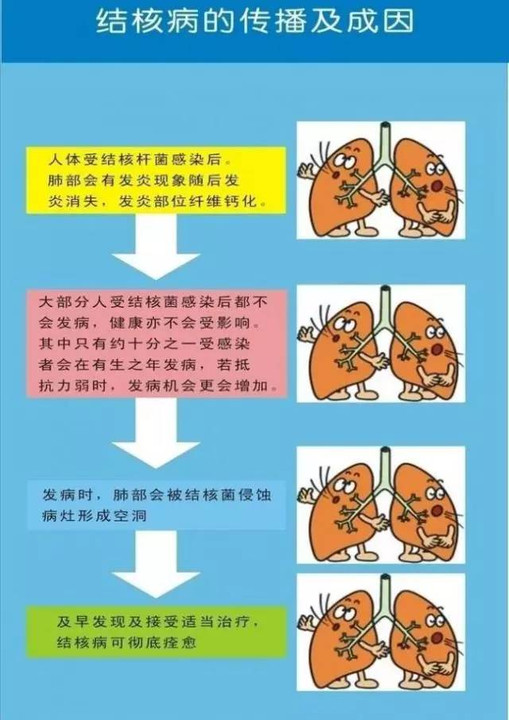 肺结核复发几率大吗_肺几率结核复发大不大_肺结核复发率大吗