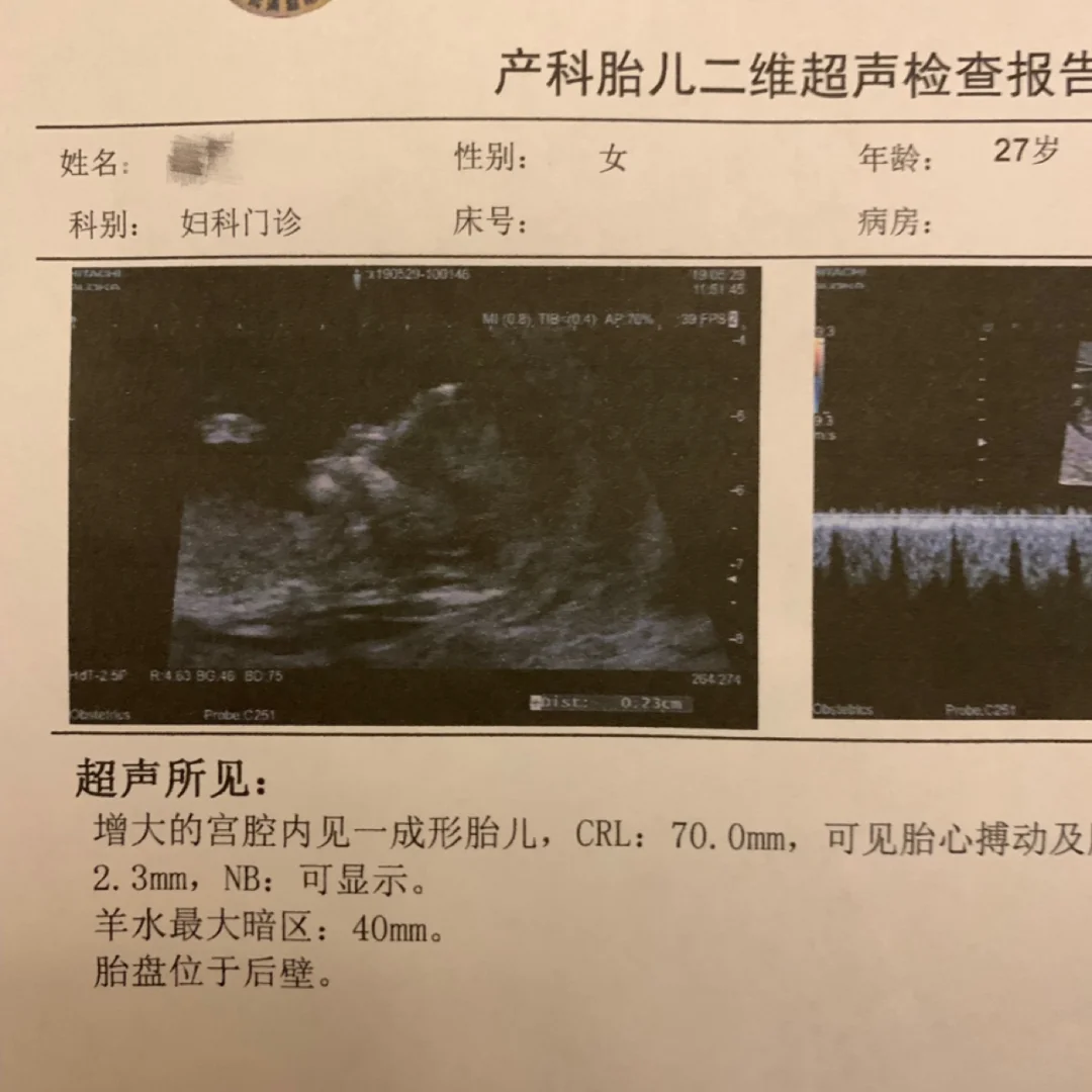 函数中k是什么意思_ntdll.dll中的nt函数_函数中如何用$锁定