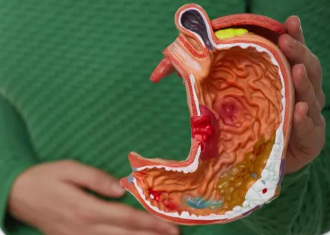 胃中医治疗胃炎溃疡的方剂_胃炎胃溃疡的中医治疗_中医治疗胃溃疡效果好吗