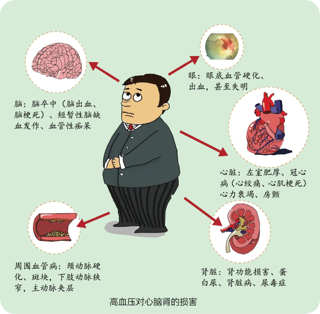 进展性脑卒中严重吗_进展脑严重性卒中的原因_严重脑卒中表现