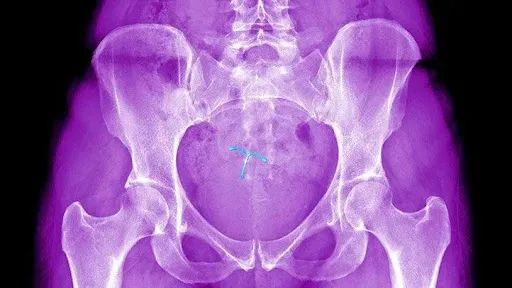 肛门手术失禁后多久恢复_肛门手术后肛门失禁_手术后肛门失禁