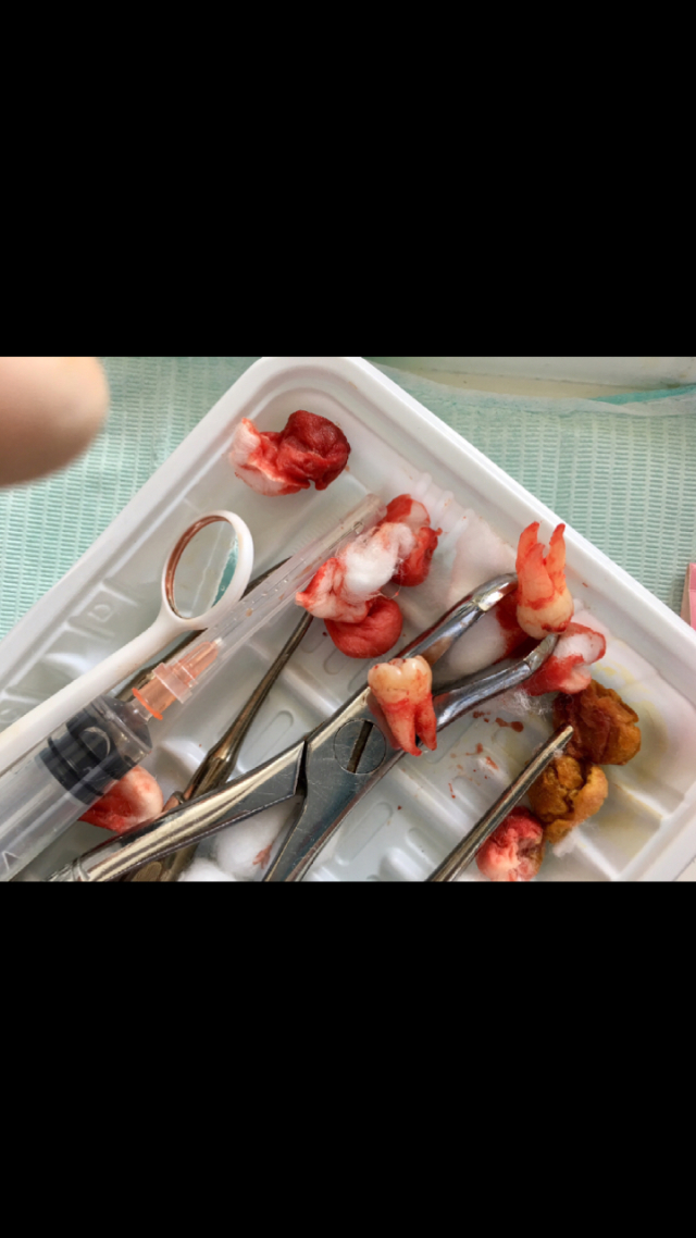 gps车载天线安装在哪里_汽车接收天线_车载gps 天线接收头拆卸