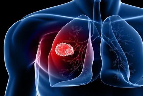 肺可怕结核有传染性吗_肺可怕结核有哪些症状_肺结核到底有多可怕