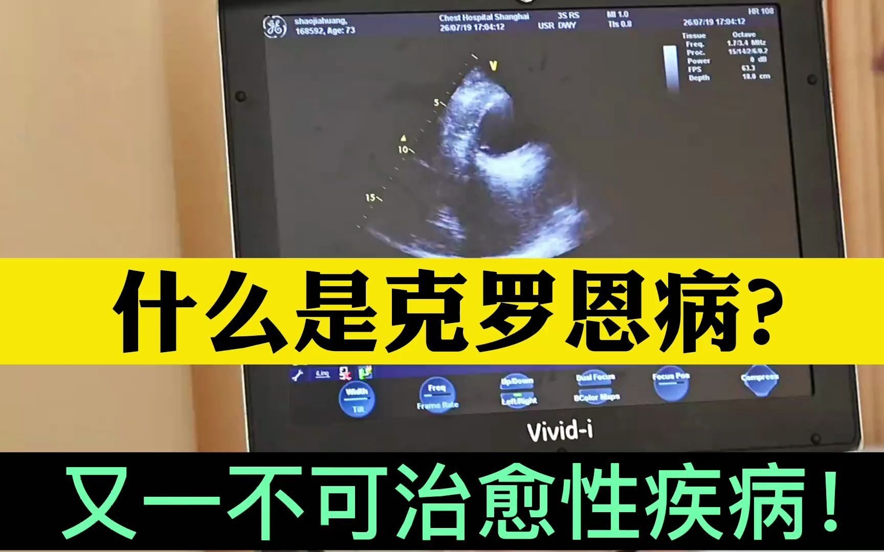 罗克罗恩病_罗克恩病早期症状_克罗恩氏病能治好吗