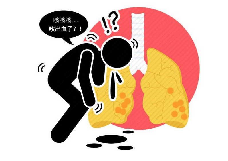 肺结核是严重的病吗_肺病结核严重是什么症状_肺结核严重是什么病