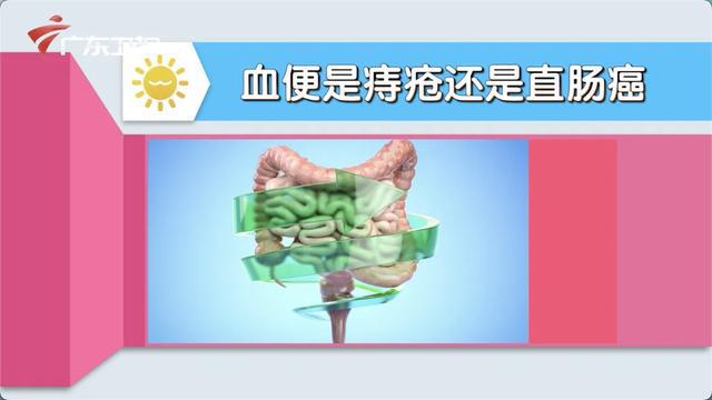 老年人大便出血是怎么回事_65岁大便出血_中老年大便出血