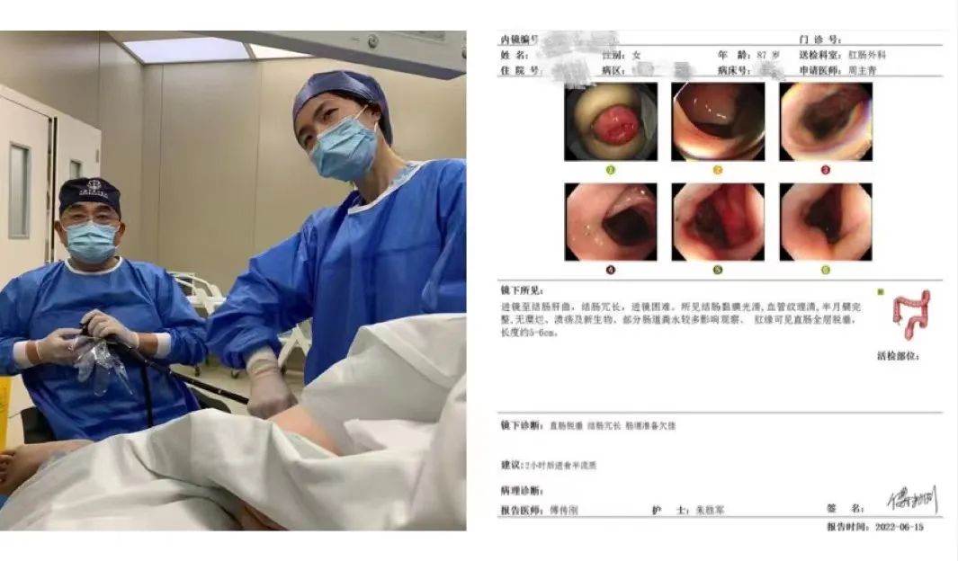 肛门括约肌失禁_肛门括约肌失禁治愈案例_肛门括约肌失禁的症状
