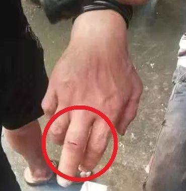 男主哮喘发作文_男主哮喘病发作的视频_男主哮喘发作了