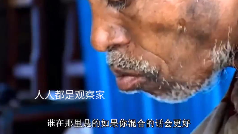 急性白血病活多久_急性白血病存活期多久_急性白血病活了20天