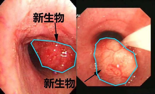数据库概念图_数据库系统概念模型_数据库系统的概念