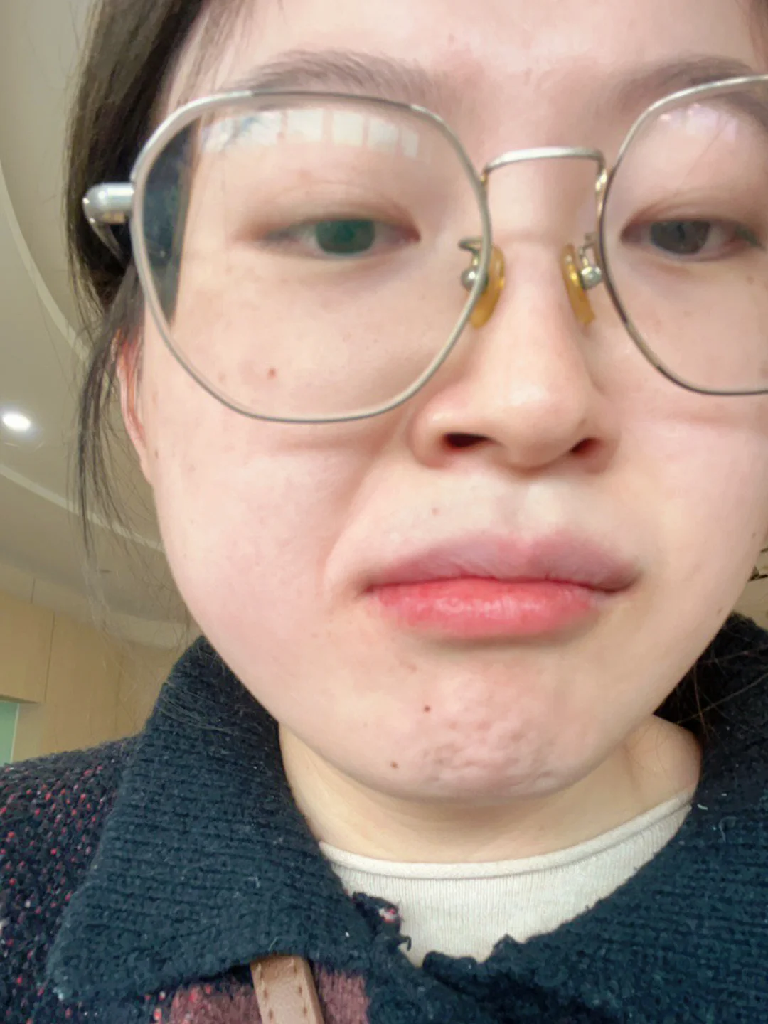 朝阳医院特需号_朝阳医院特需号怎么挂_朝阳医院特需号可以退吗