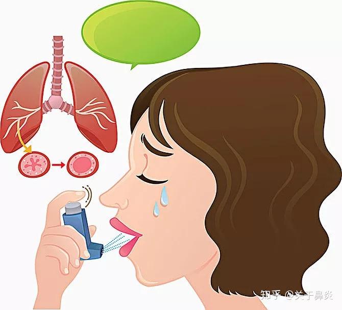 小孩有哮喘病_小孩哮喘有什么症状_哮喘症状小孩有什么表现