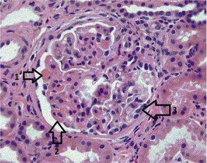 儿童肺炎甲强龙的作用与功效_甲强龙治疗儿童肺炎_小儿肺炎用甲强激素的危害