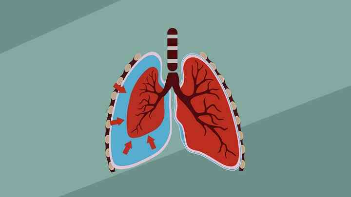 婴儿肺炎治疗完老拉稀_婴儿肺炎怎么治疗_婴儿肺炎治疗需要多长时间