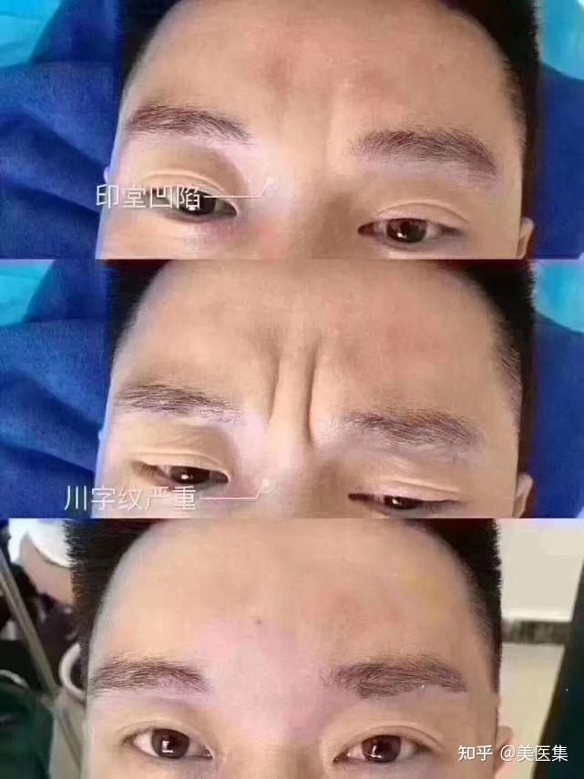 贴吧会员激活码在哪里激活_贴吧激活码怎么使用_win81激活码 贴吧