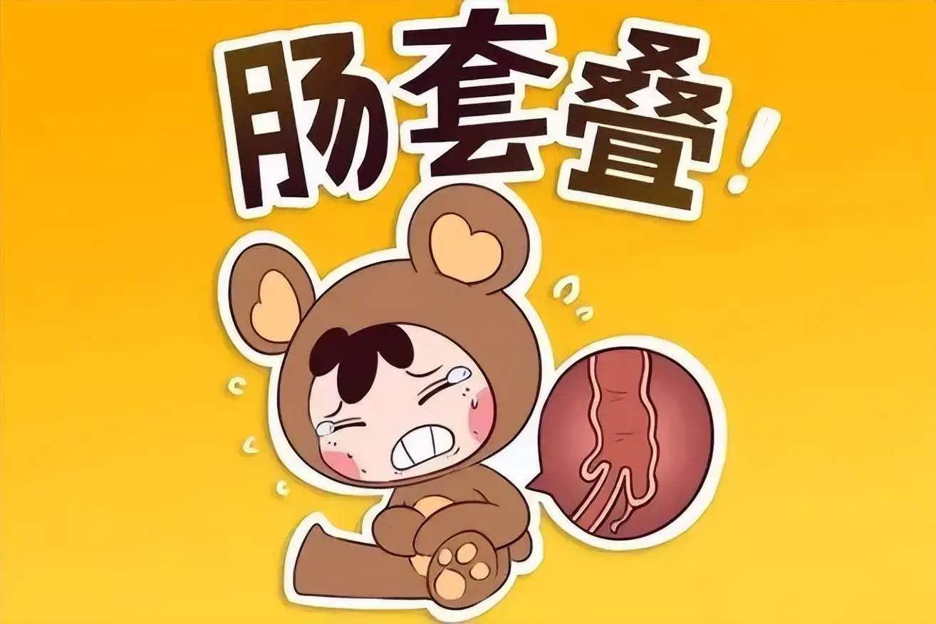 肠套叠ct图_肠套叠的典型ct征象_肠套叠ct描述模板