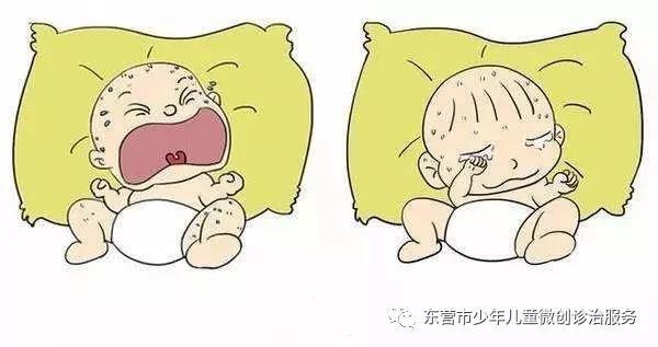 肠套叠ct描述模板_肠套叠ct图_肠套叠的典型ct征象