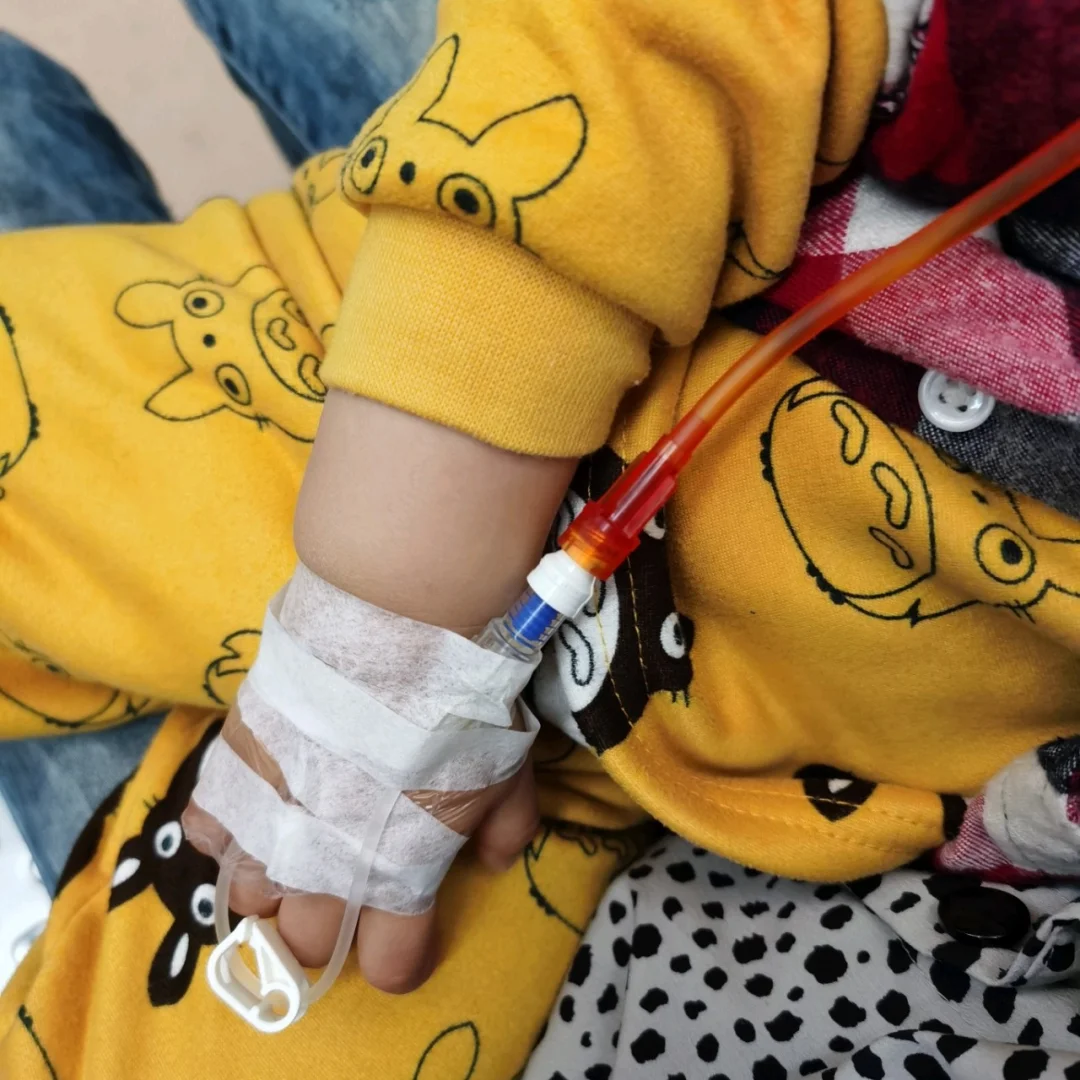 肠套叠的典型ct征象_肠套叠ct图_肠套叠ct描述模板