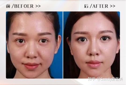 雨林木风一键装机版_雨林木风一键重装系统_雨林木风win7一键装机教程