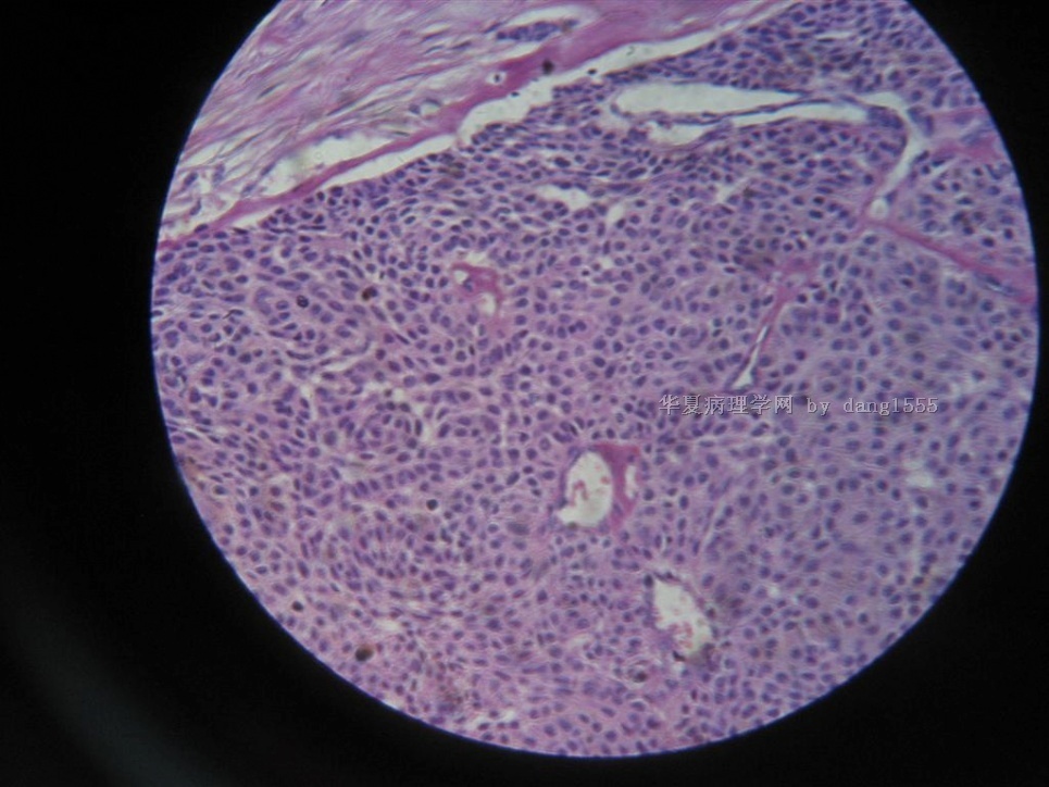 前胸后背肿痛_前胸后背疼 背部还有个肿块_前胸后背疼后背起大包