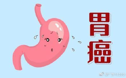 胃癌ct图片怎么看_胃癌胃部照片_胃癌ct图片大全