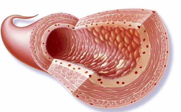 罗克罗恩病的特征性体征_克罗恩病诊断//.l_罗克恩病早期症状
