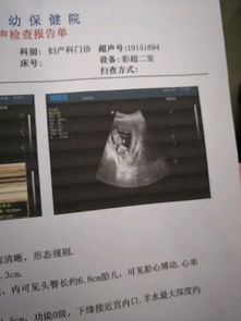 21周系统彩超,21周可以做四维彩超吗