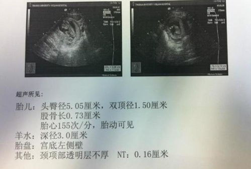 b超单系统,全面解析超声检查报告的奥秘