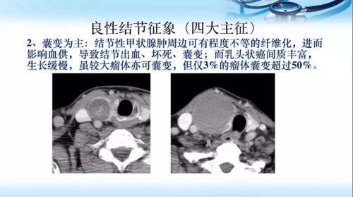 ct影像分析系统,人工智能助力医疗诊断的革新之路
