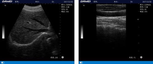 COS系统b超,技术创新与临床应用的完美结合
