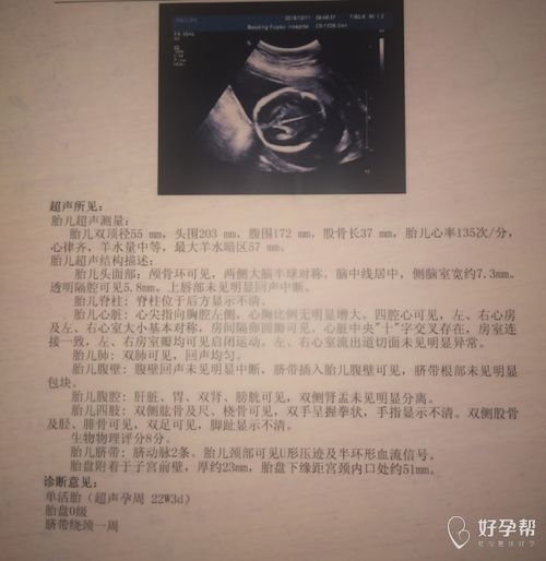 22周系统彩超查什么,22周系统彩超检查内容详解