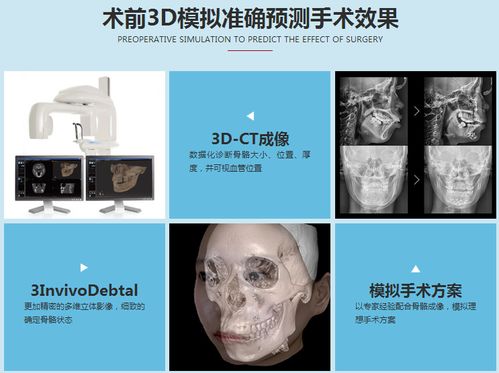 3d整形模拟系统,引领医美行业数字化革命