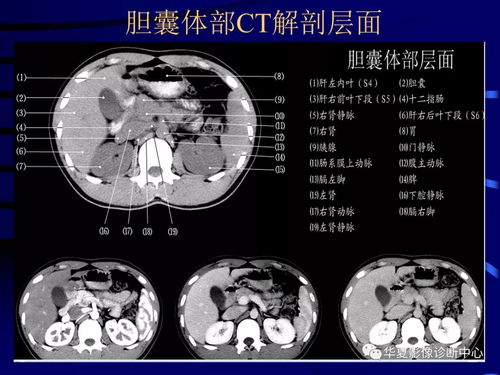 CT看图系统,医学影像诊断的得力助手