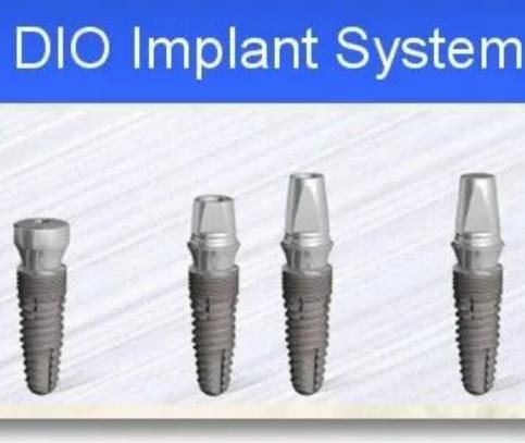 dio种植牙系统介绍,DIO种植牙系统——引领口腔修复新潮流
