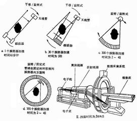 ct旋转系统,CT旋转系统的概述