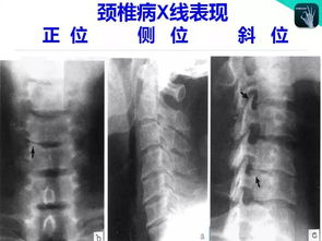 骨关节系统影像试题,骨关节系统影像试题解析——临床医师必备技能