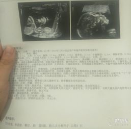 供墨系统b超,供墨系统B超技术在印刷行业中的应用与优势