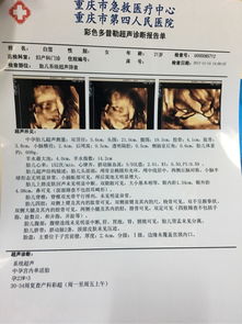 高清直播系统b超,高清直播系统在B超领域的应用与发展