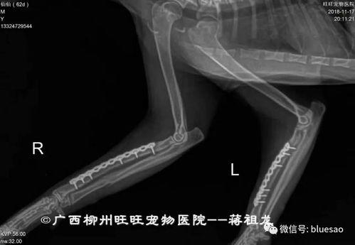 骨固定系统,骨固定系统在现代医学中的应用与进展